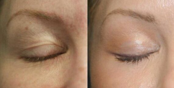 Take care of areas near the eyes
