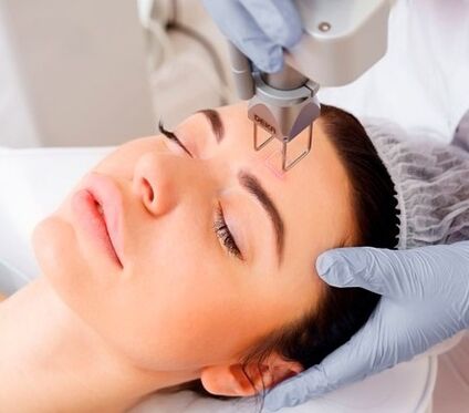 the essence of the procedure of fractional laser facial skin rejuvenation